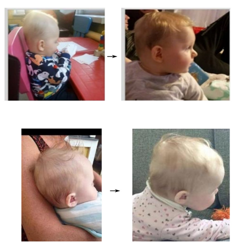 Poduszka ortopedyczna dla niemowląt na płaską główkę Good Head | Biała | L na Arena.pl