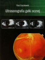 Fryczkowski Ultrasonografia gałki ocznej