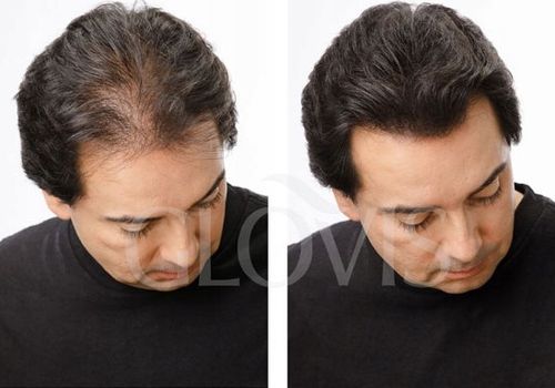 Saszetka GLOVIS 50g - Ciemny Brąz - Dark Brown Maskowanie Przerzedzeń Wł. na Arena.pl