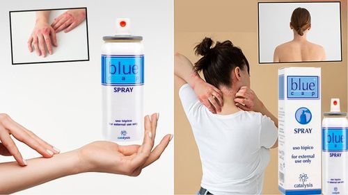 Blue Cap Spray 200 ml na łuszczycę AZS egzema - łagodzący świąd skóry na Arena.pl