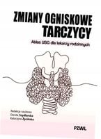 Zmiany ogniskowe tarczycy. Atlas USG dla lekarzy rodzinnych - Życińska