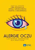 Alergie oczu. Ilustrowane kompendium dla praktyków