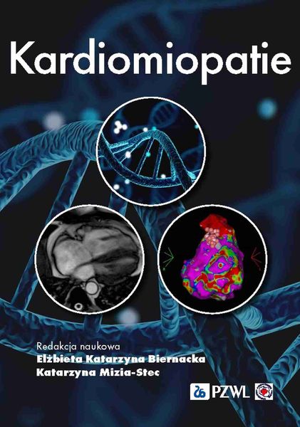 Kardiomiopatie zdjęcie 1