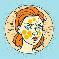 NATURALNA KURACJA NA ŁOJOTOKOWE ZAPALENIE SKÓRY ŁZS ŁUPIEŻ GRZYBICĘ EGZEMA