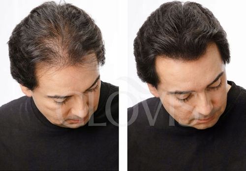 Włókna GLOVIS 50g Eko-Saszetka Mikrowłókna Zagęszczanie Rzadkich Włosów* na Arena.pl