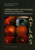 Czerniak błony naczyniowej Diagnostyka
