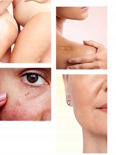 Bio-Oil Specjalistyczny olejek do pielęgnacji skóry 125ml na Arena.pl