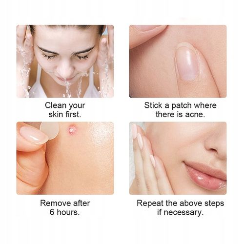 Plastry hydrokoloidowe na wypryski pryszcze 72 szt na Arena.pl