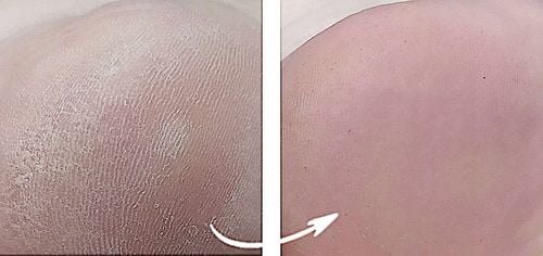 Spray na grzybicę paznokci stóp ze srebrem 250ml Srebro Koloidalne na Arena.pl