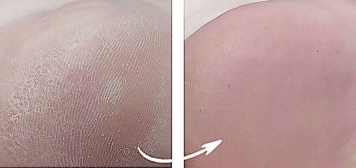 Spray na grzybicę paznokci stóp ze srebrem 250ml Srebro Koloidalne zdjęcie 3