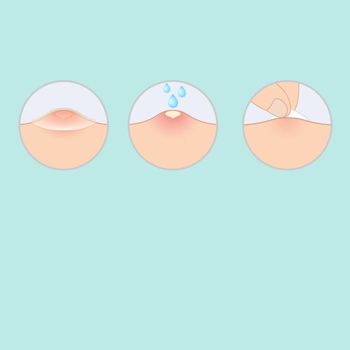 COSRX Acne Pimple Master Patch Plasterki na wypryski -72sztuk na Arena.pl