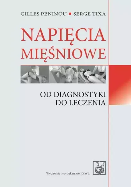 Napięcia mięśniowe zdjęcie 1